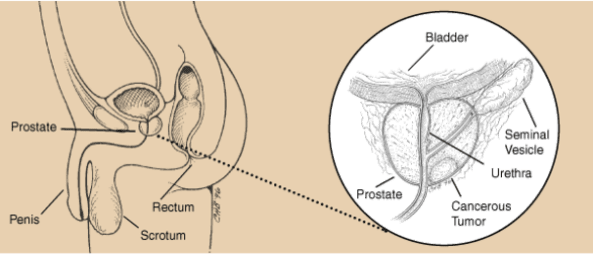 A diagram showing the anatomy of a knee.